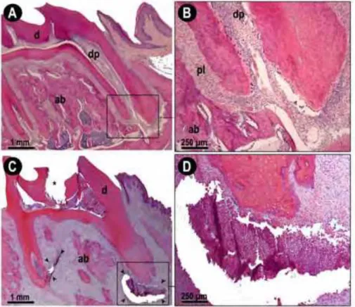 FIGURA 3 - Fotomicrografias de molar saudável (controle-CN) e molar  com lesão periapical (LP) após 30 dias