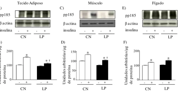 FIGURA 9 - Avaliação do grau de fosforilação em tirosina da pp185 (IRS-1/IRS-2) antes (-)  e após (+) o estímulo insulínico no tecido adiposo branco periepididimal (A, B),  músculo gastrocnêmio (C, D) e fígado (E, F) de ratos-controle (CN) e de ratos  com 