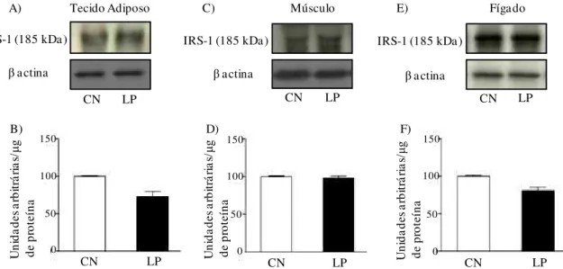 FIGURA 10 - Avaliação do conteúdo do IRS-1 no tecido adiposo branco periepididimal (A,  B), músculo gastrocnêmio (C, D) e fígado (E, F) de ratos-controle (CN) e de  ratos com lesão periapical (LP)