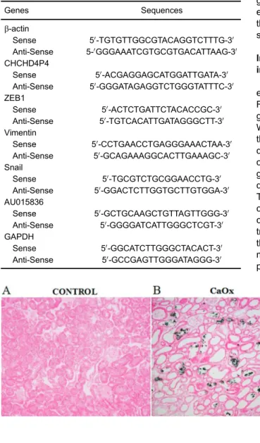 Figure 1. Von Kossa-stained sections of kidneys from mice in the control and experimental groups (experimental group was injected with glyoxylate for 5 days)