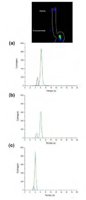 Figura 10. Registros cintilográficos de um voluntário: (a) cápsula com 0,5 g de ferrita; (b) cápsula com 0,8 g  de ferrita; (c) cápsula com 1,0 g de ferrita