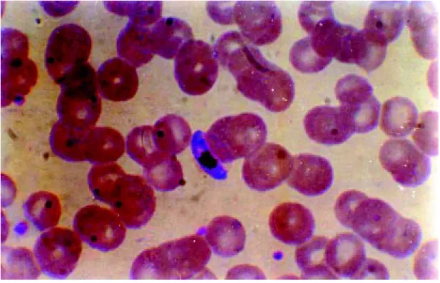 Figure 2. Gametocyte of Plasmodium falciparum. Giemsa stain, under oil immersion (X 1200).