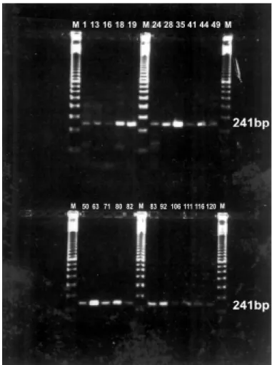Figure 1. Analysis by agarose gel (2%) electrophoresis of the PCR products. The 241 bp DNA corresponds to the specific chlamydial amplified plasmid DNA sequence