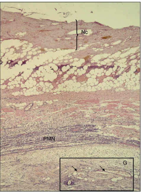 Figura  09  –  Fotomicrografia  de  corte  histológico  de  pele  murina  do  grupo  Estudo  IP  evidenciando  necrose  superficial  (Nc)  associadamente  à  presença  de  células  polimorfonucleares  (PMN),  área  de  granulação  (Gr)  com  neoformação va