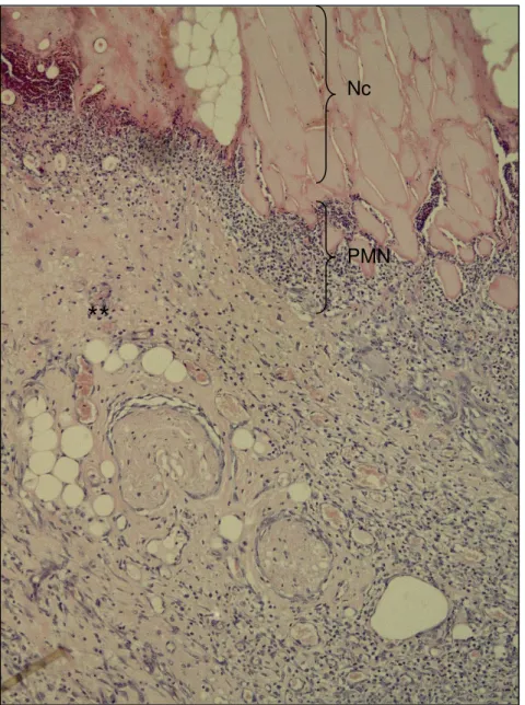 Figura 10 – Fotomicrografia do corte histológico anterior em  maior  aumento,  evidenciando  de  necrose  superficial  (Nc)  com  eosinofilia,  associadamente  à  presença  de  células  polimorfonucleares  (PMN),  área  de  granulação  (**)  com   neoforma