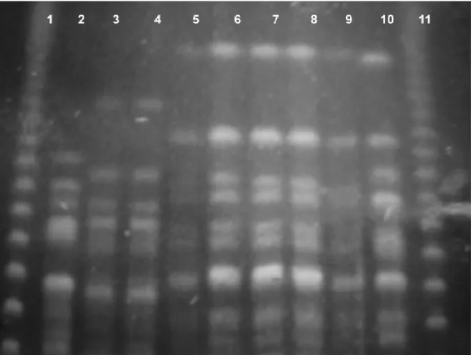 Figure 1. Pulsed field gel electrophoresis patterns of carbapenem-resistant Pseudomonas aeruginosa