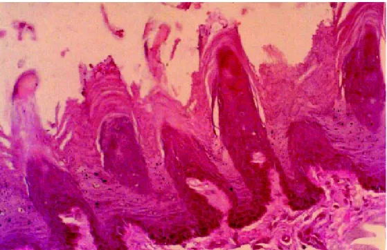 Figure 2. Oral candidiasis in immunosuppressed rats treated with carvacrol (13 mM)  twice a day for eight days.