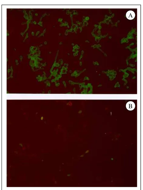 FIGURA 2 - Reações de imunofluorescência indireta (IFI). A) Reação positiva em soro de paciente com paracoccidioidomicose, mostrando fungos com intensa fluorescência da parede celular (Aumento 400x)
