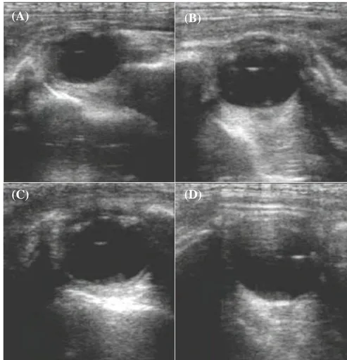 Figura 5 - Imagens ultrassonográficas do olho fetal de uma cria da Raça Asinina  de Miranda aos 205 dias (A), 245 dias (B), 275 dias (C) e 311 dias (D) de idade; 