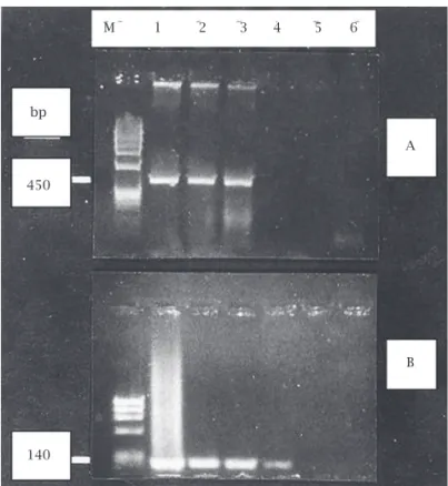 Figure 1: A; (HPV) M: fX174 DNA /  Hae III  marker. Lanes 1,  2, 3: HPV positive patients
