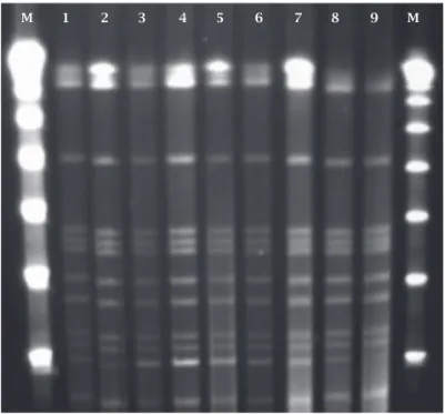 Figure 1: PFGE pattern of  M. massiliense  isolates from  Curitiba outbreak. M, molecular size markers (Lambda  DNA  concatemers  ranging  from  48.5  to  1,018.5  kb);  lane  1,  CRM-587; lane 2, CRM-591; lane 3, CRM-592; lane 4, CRM-593; 