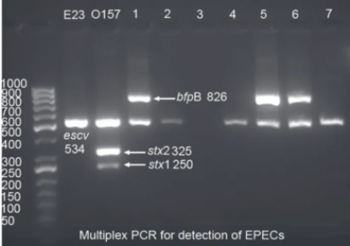 Figure 1: Multiplex PCR for detection of EPECs. Lanes 1-7  showing strains identified as typical and atypical EPEC.