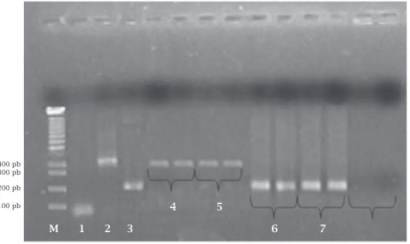 Figure 1. Limit detection of Multiplex-PCR in detection of  DNA from E. dispar. Amplified PCR products using Eh-R/