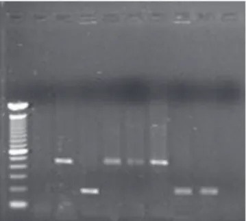 Figure 4. Analysis of 262 E. histolytica/E. dispar positive sam- sam-ples by Multiplex-PCR