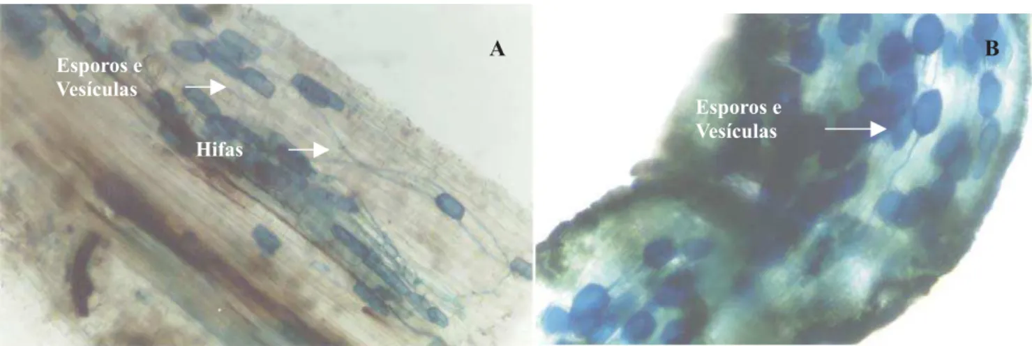 Figura 1. Raiz de citros, híbrido HTR 127 (A) e Limão 'Volkameriano' (B), colonizada por espécies nativas de fungos micorrízicos arbusculares, em pomar de pés-francos oriundos de mudas sem inoculação