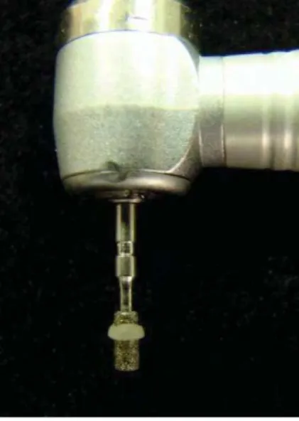 FIGURA 3 - Batente de resina composta confeccionado na ponta diamantada para  padronização da profundidade do preparo cavitário em 2 mm