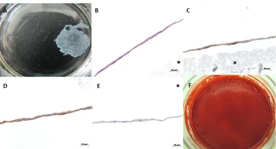 Figure 1 - Macroscopic view (A,F) and histological characterization (B-E) of hBMSCs cell sheets cultured  for  14  days  in  osteogenic  medium;  (A)  Osteogenic  cell  sheets  derived  from  hBMSCs  after  detachment  and contraction