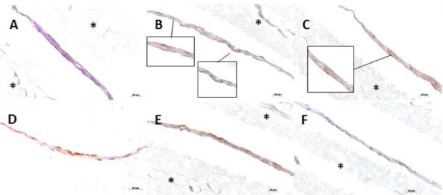 Figure 5 -  Histological analysis of co-cultured cell sheets after H&amp;E staining (A) and immunostaining for  CD31 (B), CD146 (C); osteocalcin (D) and type-I collagen (E)