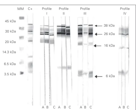 Figure 3. Western blot profile shown by tuberculosis patients. A, Sample before patient treatment;  B, sample after two months of treatment; C, sample after 6 months of  treat-ment