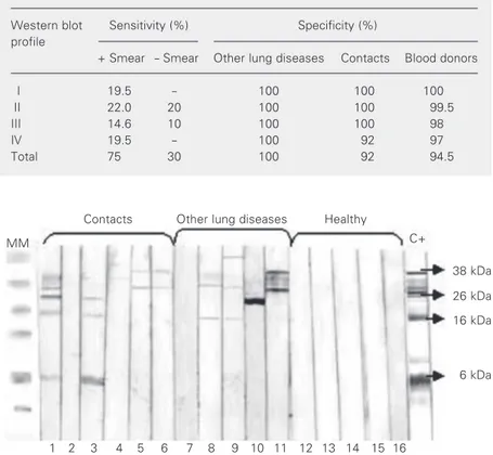 Figure 4. Western blot profile shown by contacts, other lung diseases and healthy individu- individu-als