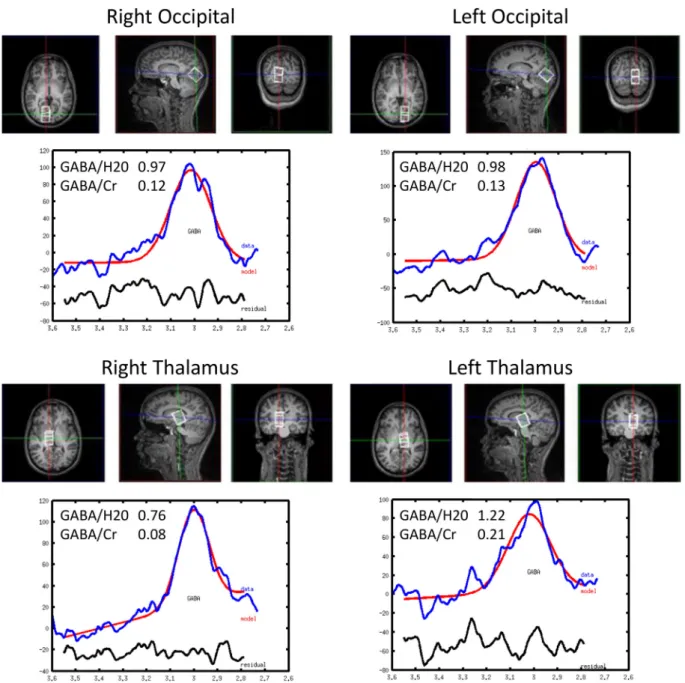 Fig. 3. Dynamics of average independent components (ICs) resulting from decomposition of the SW recorded during simultaneous EEG–fMRI, classiﬁed in spike (S) and wave (W) events.