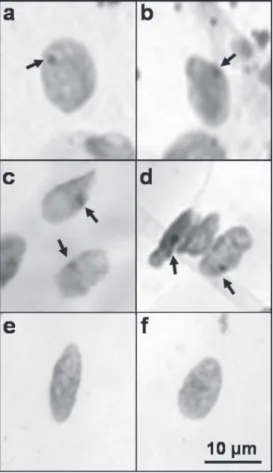 Figure 1. Ectopic development of skeletal muscle induced by subcutaneous transplantation of rat satellite cells