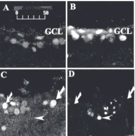 Figure 2. A,B, Immunostaining for Max in explants at 30 h in vitro, from retinae intravitreally injected either with PBS (A) or with recombinant  adeno-associ-ated viral (rAAV)-max (B)