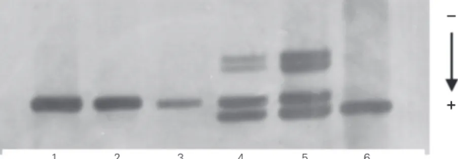 Figure 1. Analysis of the  ∆ F508 mutation in 7% polyacrylamide gel stained with AgNO 3 
