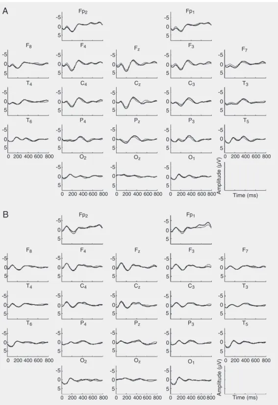 Figure 2. Example of resulting grand-averaged event-related potentials for all derivations in: