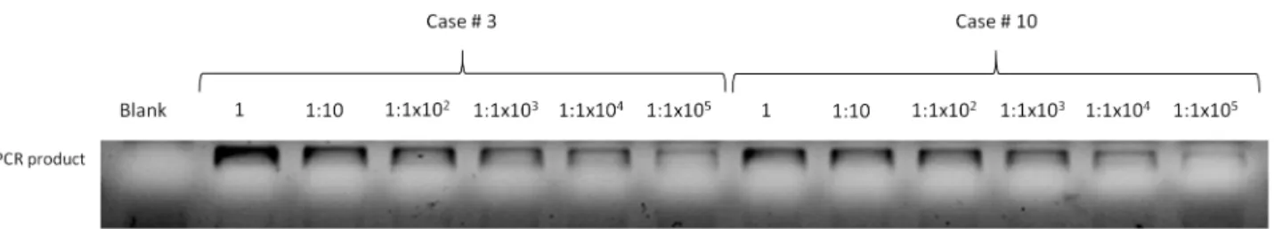 Fig 2. Highly sensitive PCR for detection of H . pylori . In order to evaluate the sensitivity of VacA -specific PCR, 50ng of DNA from H 