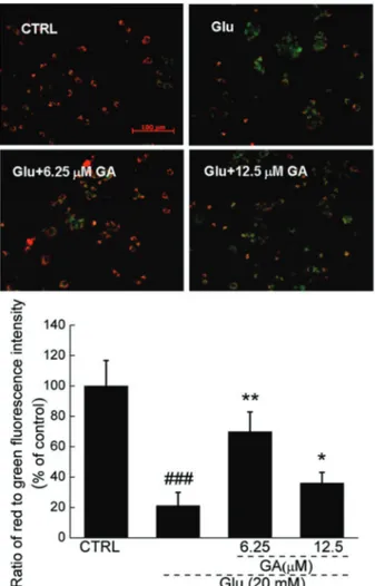 Figure 2. Glycyrrhizic acid (GA) restored glutamate-disturbed mitochondrial function (206; Scale bar: 100 mm)