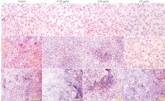 Figure 7. Immunohistochemical staining revealed the presence of type I collagen. Chondrocytes cultured in vitro with 0 (control), 0.125, 0.25, and 0.5 mg/mL JJYMD-C for 2, 4, and 6 days