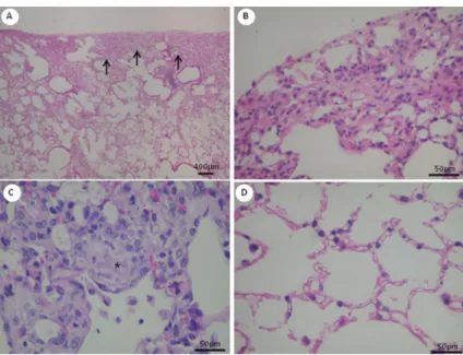 Table 1 shows histomorphometric results. AEC2 expressing telomerase are significantly increased in normal and chronic scarring areas of UIP when compared