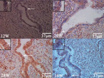 Figure 4. Positive expression of c-myc (arrows) in the common bile duct cells in the cytoplasm and nucleus at different fetal stages (12, 20, 28, and 38 weeks).