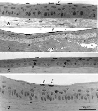 Figure 4. Autoradiography of sections of different regions of the same cornea 28 days after a single intravitreal injection of [ 3  H]-TdR
