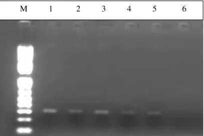Figura 4. Produtos de mPCR obtidos com DNA extraído a partir de concentrações seriadas de  S
