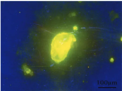 Figure 6. Tetracycline labeling for ﬁ broblasts induced with 40 mg/mL ﬁ bronectin showing golden nodules, which had a trabecula-like structure