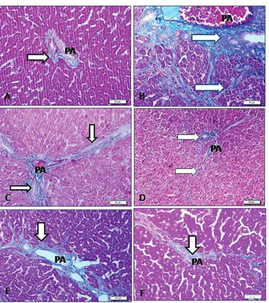 Figure 5. Sections of rat liver stained with Masson ’ s trichrome (  600). A, Normal control group showing normal collagen distribution around portal area (PA)