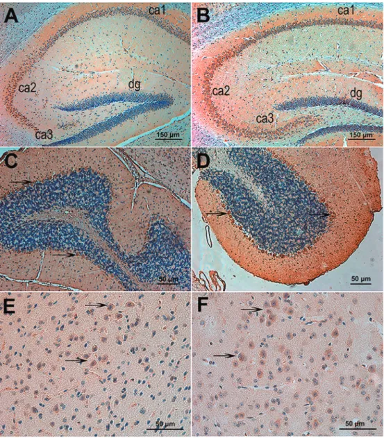 Figure 2. Immunohistochemistry of mouse Down syndrome cell adhesion molecule (DSCAM) in sagittal brain sections from 3-month-old mice