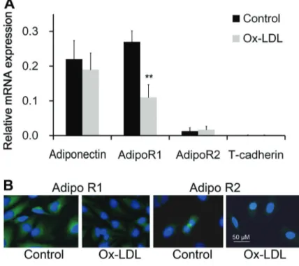 Figure 2. The effect of adiponectin on regulation of adipoR1 expres- expres-sion in cells treated with oxidized low density lipoprotein cholesterol (ox-LDL) was assayed by real-time PCR (n=4)