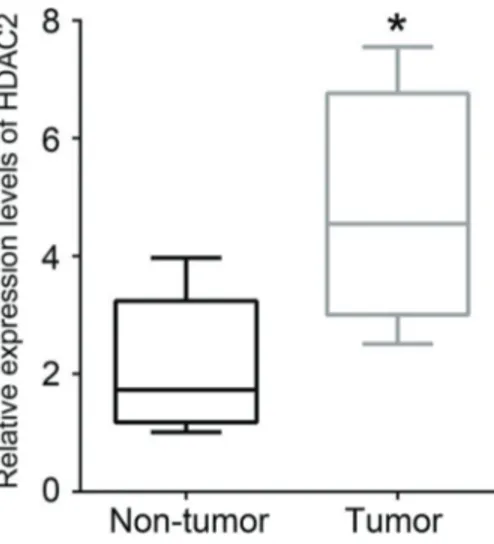 Figure 2. Knockdown of HDAC2 reduced cell viability in HCT116 cells. Cells were infected with shRNA-NC or HDAC2 shRNA.