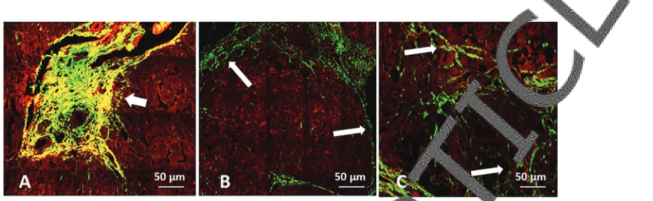 Figure 4. Second harmonic generation and two-photon excited ﬂ uorescence images of different patterns of ﬁ brosis by different etiologies