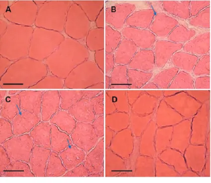 Figure 3. Quanti ﬁ cation of muscle ﬁ ber areas. Muscle samples were obtained on day 21 after tenotomy from all experimental groups