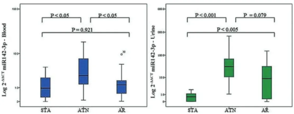 Figure 2. Receiver operating characteristic curves (ROC) of miR-142-3p expressions in the peripheral blood and urine of renal transplanted recipients