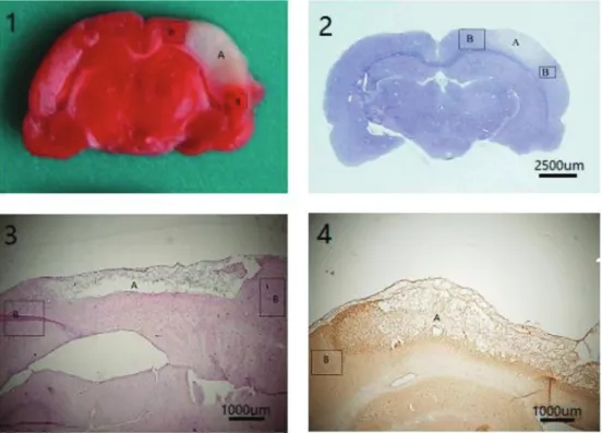 Figure 1. TTC-stained (1), Nissl-stained (2), HE-stained (3), and IHE-stained (4) coronal brain sections of rats showing the infarction area (A) and the peripheral regions evaluated (B, rectangle indicates the observed location).