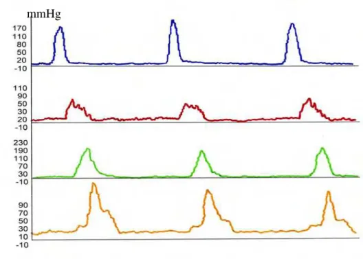 Figura 7. Avaliação da atividade motora do corpo esofágico, mostrando peristaltismo  normal