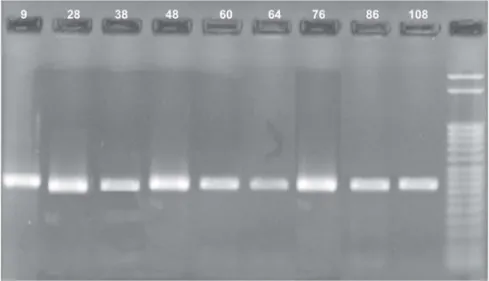 Figure 8. Electrophoresis in a 1.5% agarose gel of the product of the second reaction of nested PCR of gene C of HBV