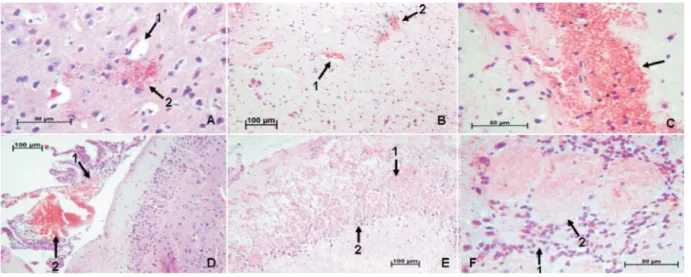 Figure 2. Anatomopathological analysis with different observed lesions in encephala of experimentally infected mice with Toxoplasma gondii, stained by hematoxilin-eosin technique: A1 – perivascular edema, A2 – tachyzoite forms (40x), B1 – parenchymal hyper