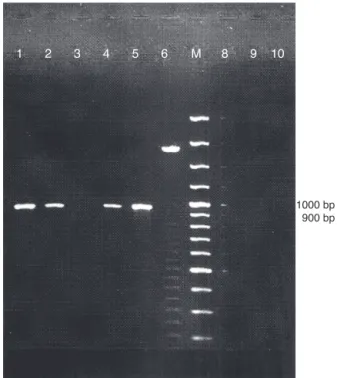 Fig. 2 – Representative eletroforetic pattern of PCR amplified products of choE in genomic DNA samples of suspected Rhodococcus equi