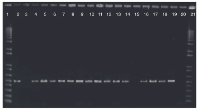 Fig. 3 – Detection of bla OXA-23 -like genes in Acinetobacter spp. clinical isolates. Lines 1 and 21: 1 Kb Plus DNA Ladder;